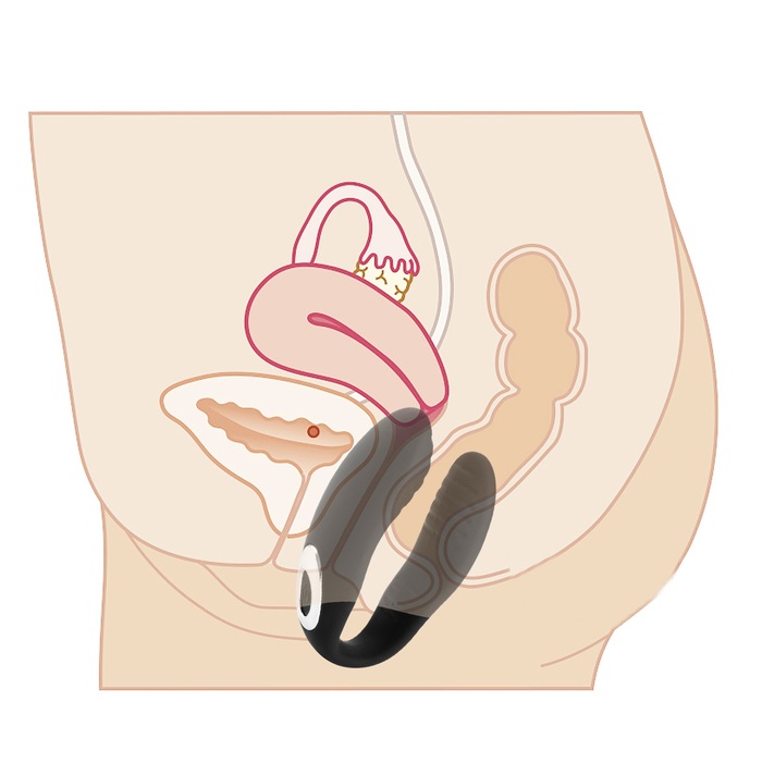 VIBRADOR DE CASAL NANA COM CONTROLE WIRELLES E RECARREGÁVEL VIA USB - Imagem 4